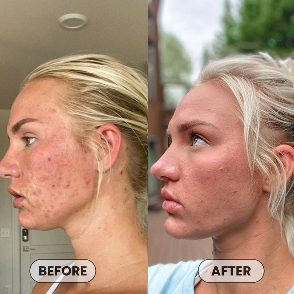 <p>Loved by 24,051+  Women</p>