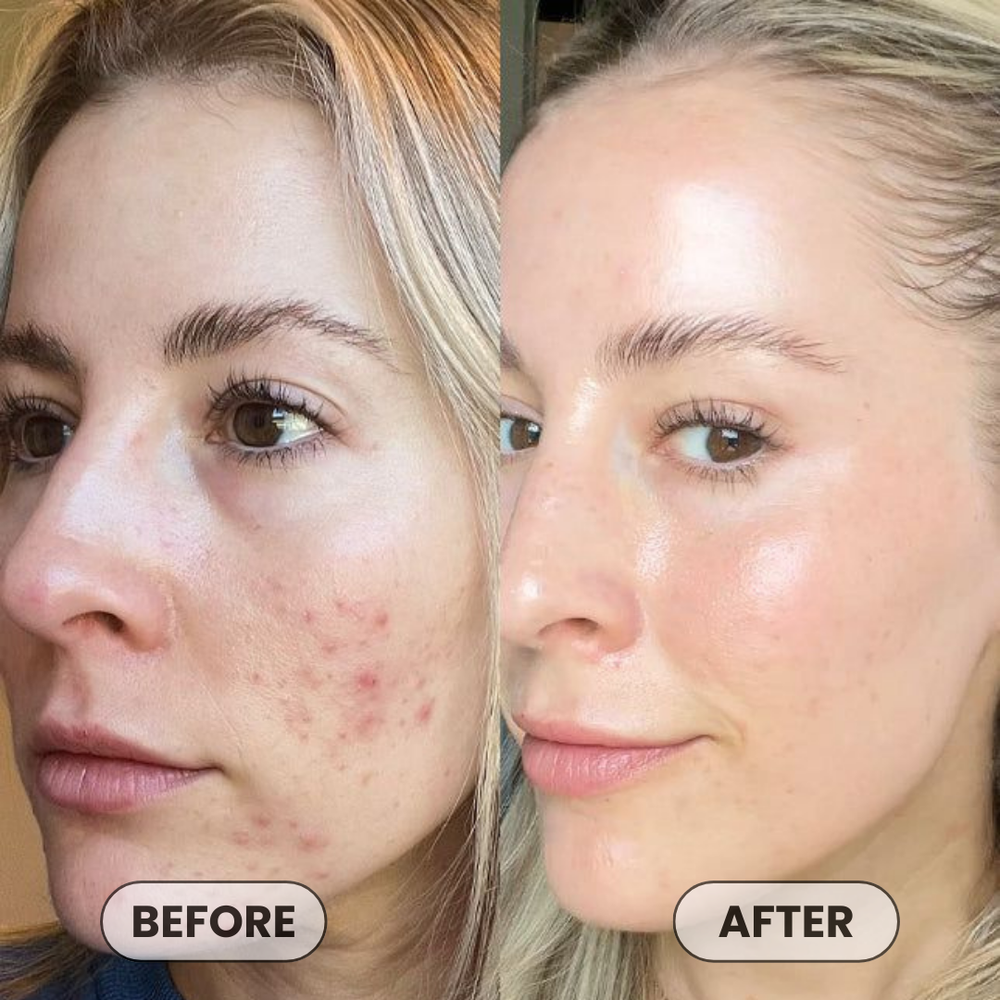 <p>Loved by 24,051+  Women</p>