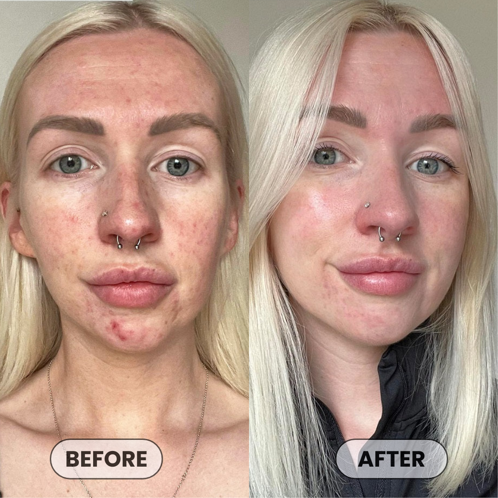 <p>Loved by 24,051+  Women</p>